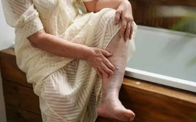 How to Prevent Amputation of a Diabetic Foot