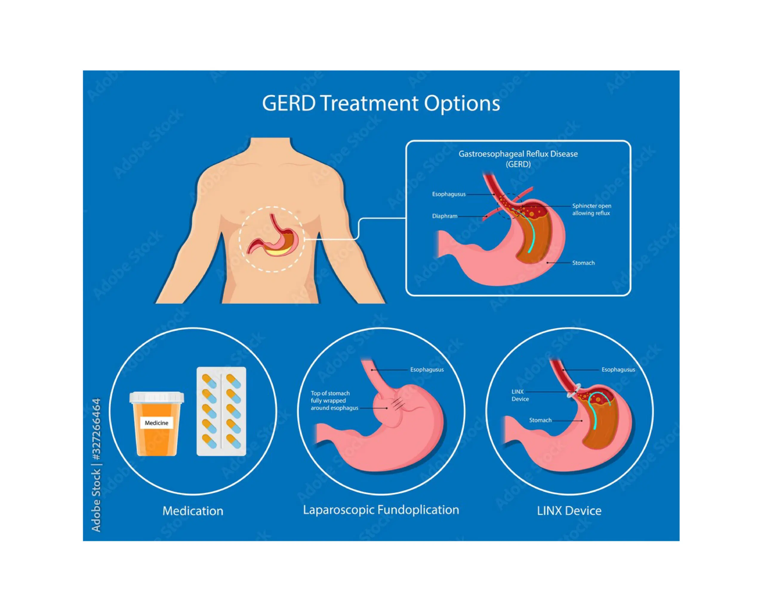 A patient has his abdomen examined in the background while a doctor points to a gallbladder on an anatomical model of the pancreas