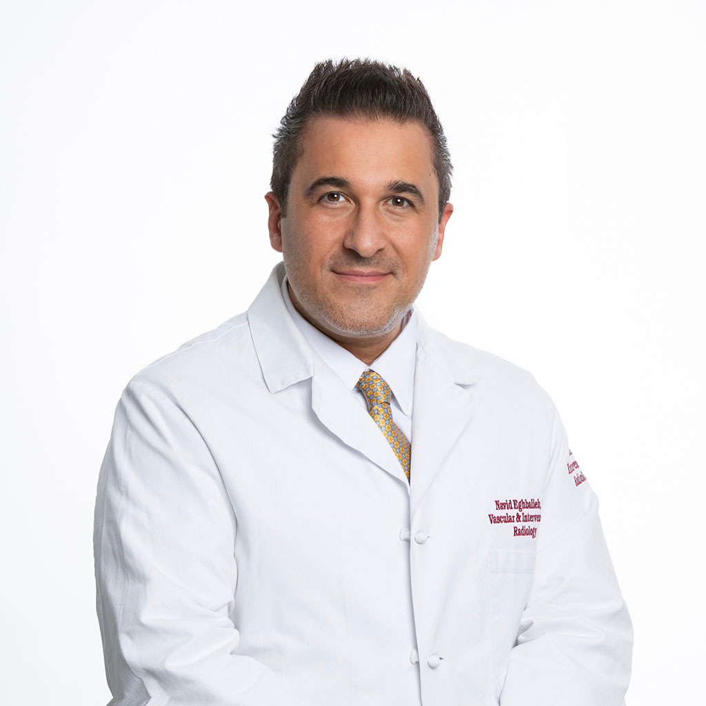 Dr. Navid Eghbalieh, the interventional radiologist of SCMSC in Los Angeles wearing white coat
