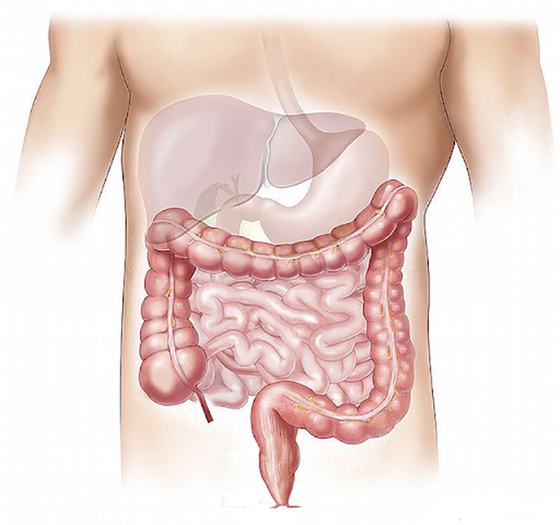 Diagram of the internal organs noting the colon for people with bowel cancer who want colon cancer treatment with a colo rectal surgeon in Los Angeles
