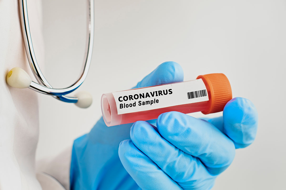 Coronavirus blood sample for COVID-19 antibody testing