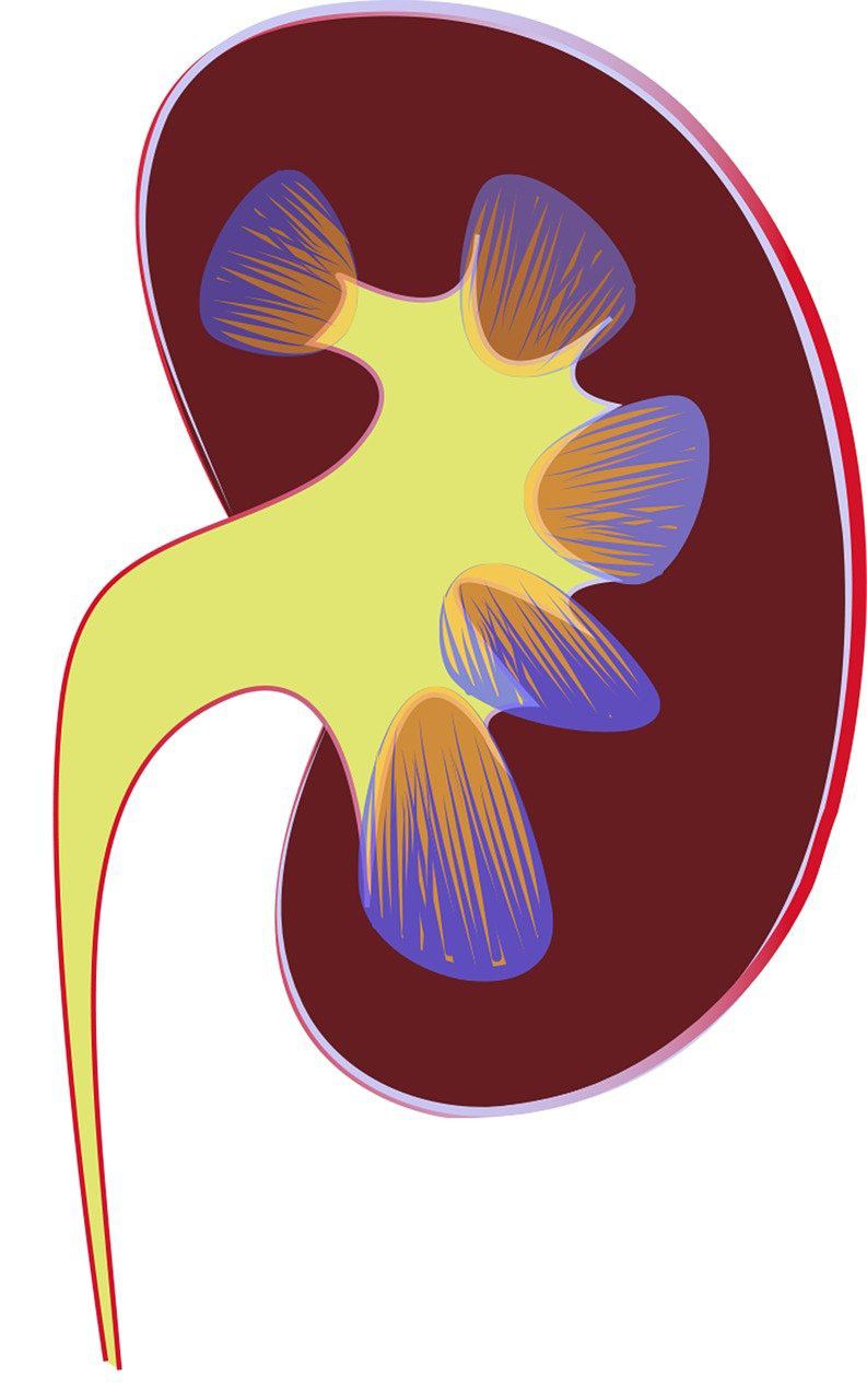 kidney illustration showing a kidney in acute renal failure