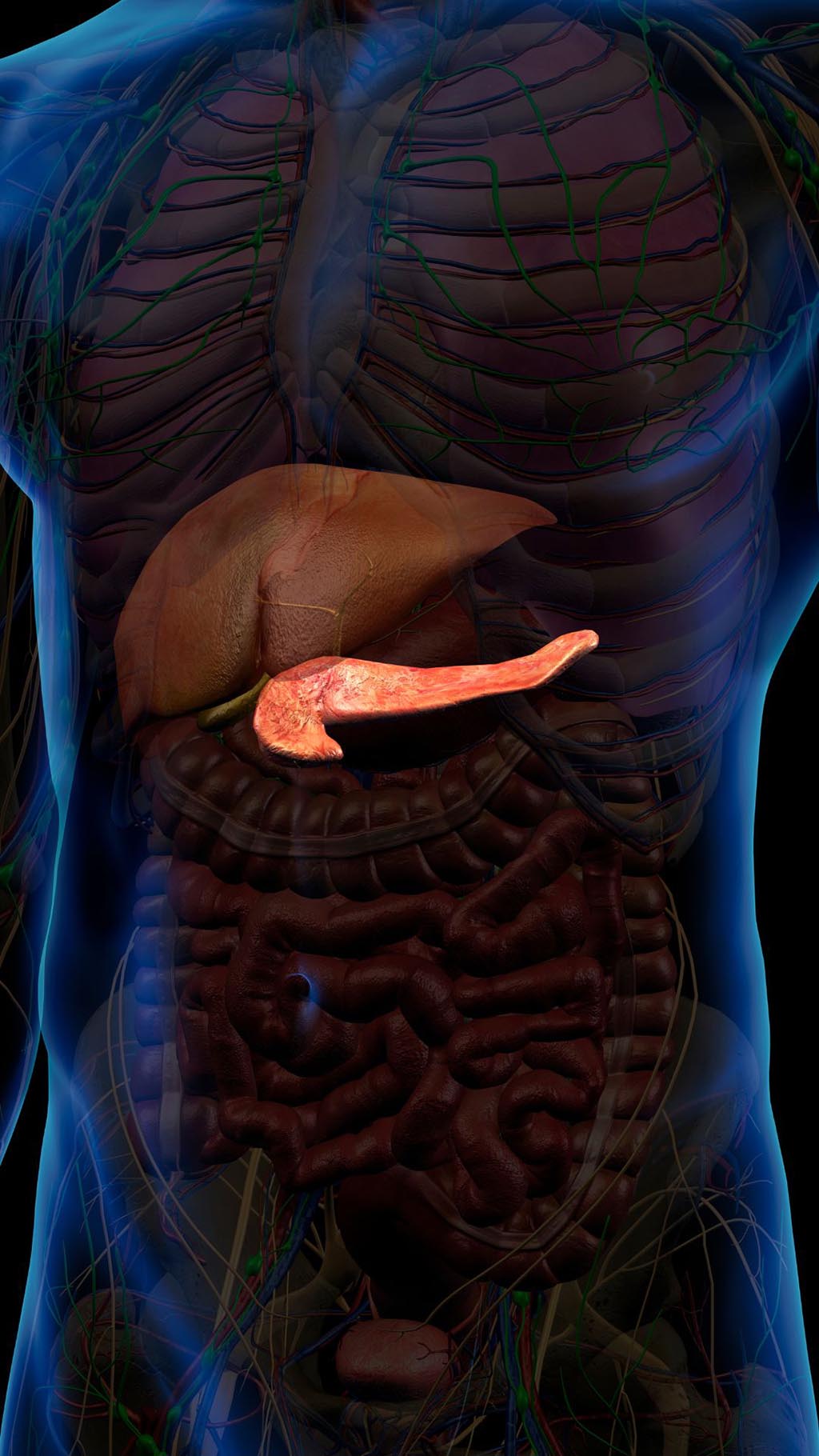 Early detection is of critical importance for pancreas cancers