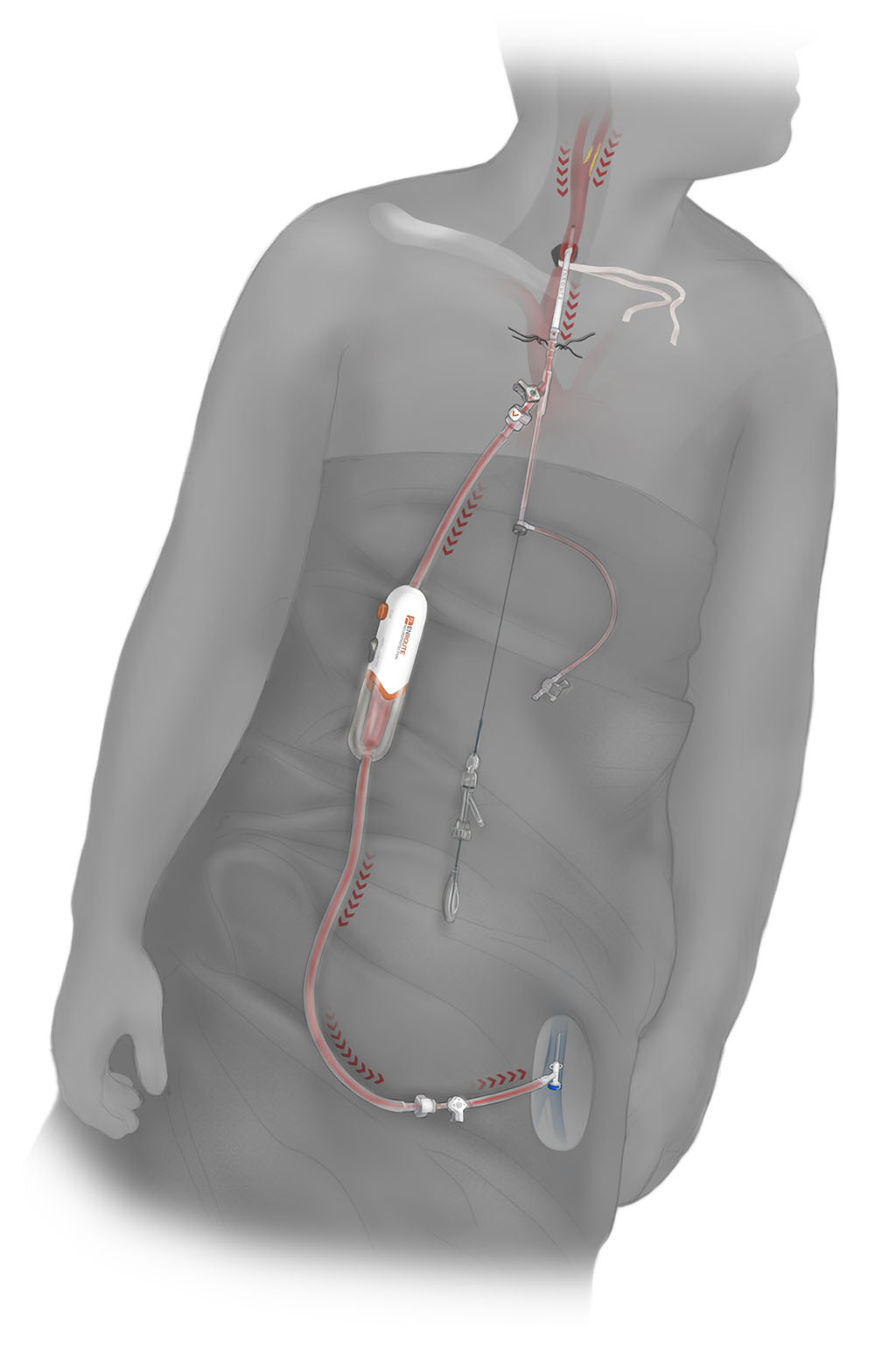 human body circulatory system in which SCMSC specialists perform an angiogram procedure